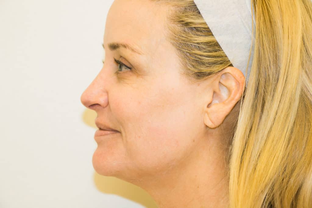 Skin care over 50